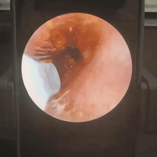 EarVision® HygienePro